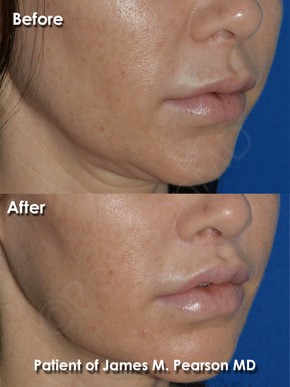 Dr. Pearson Plastic Surgery