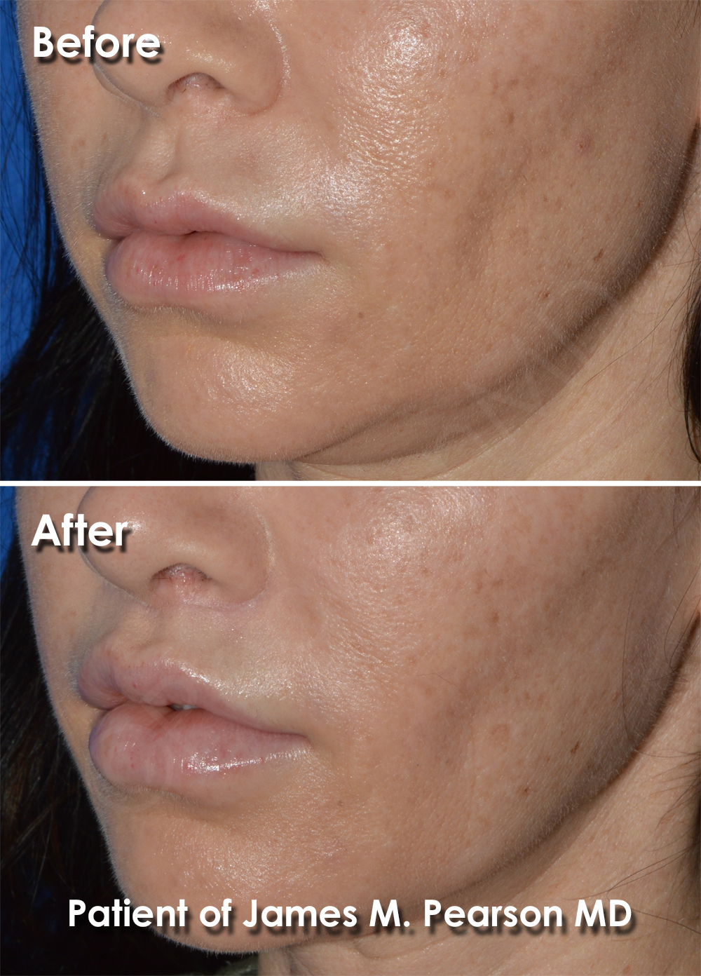 Pearson Cosmetic Surgery