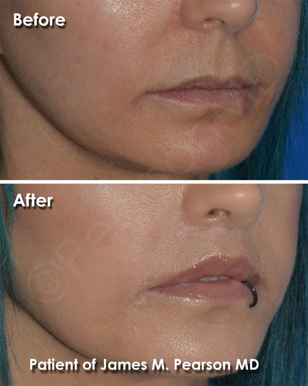 Pearson Cosmetic Surgery