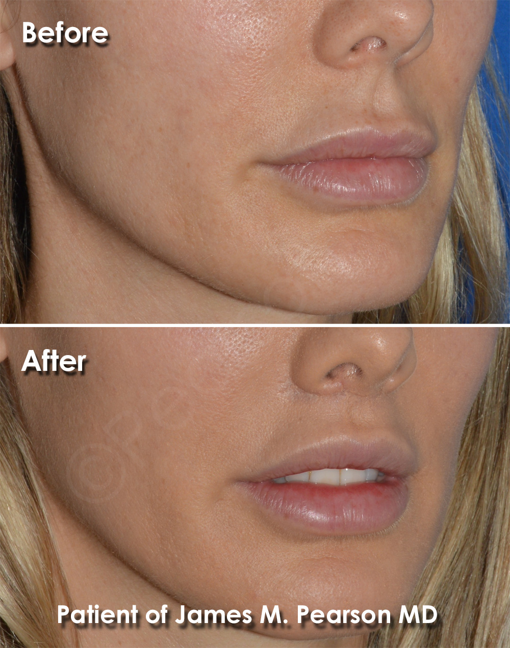 Pearson Cosmetic Surgery
