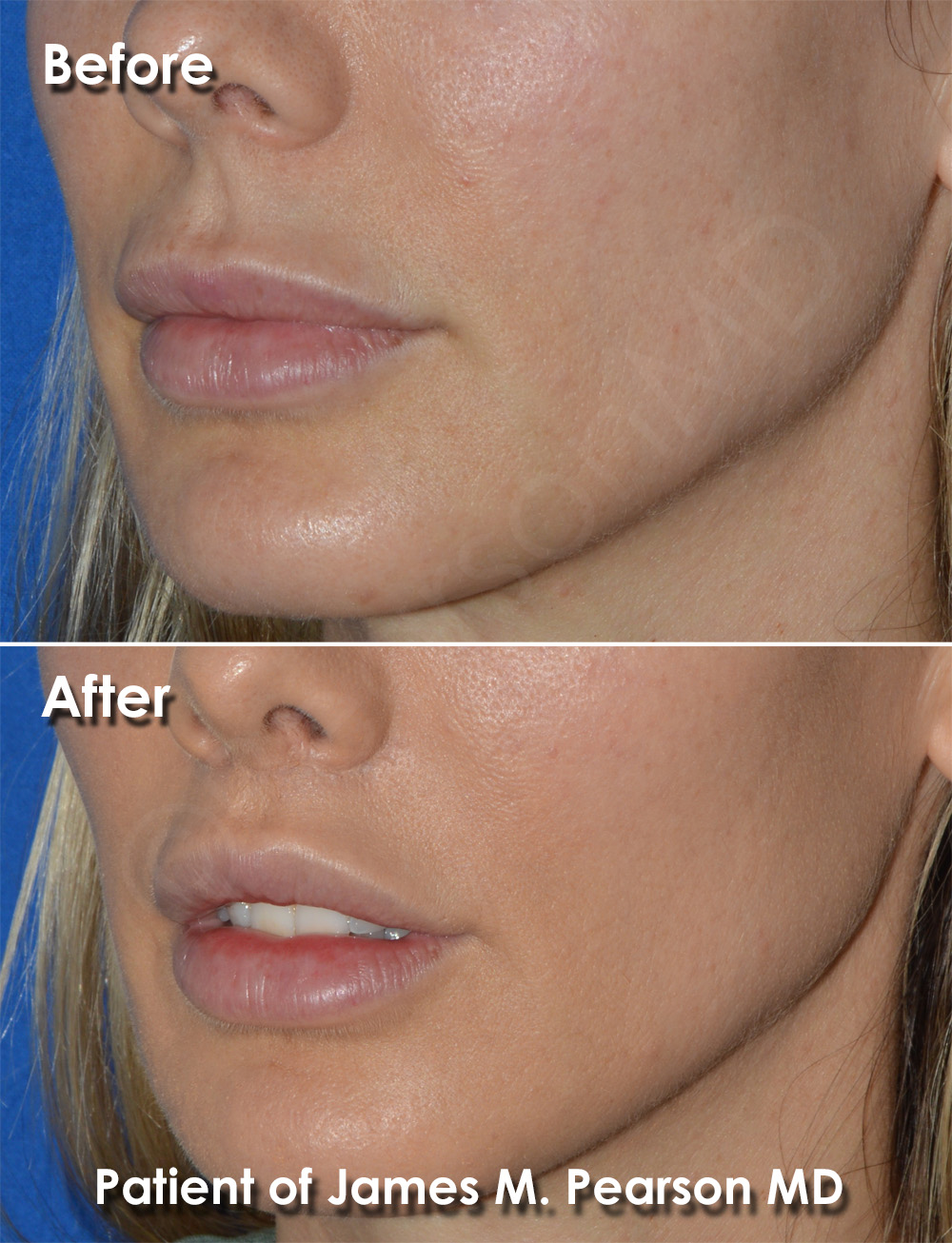 Dr. Pearson Plastic Surgery