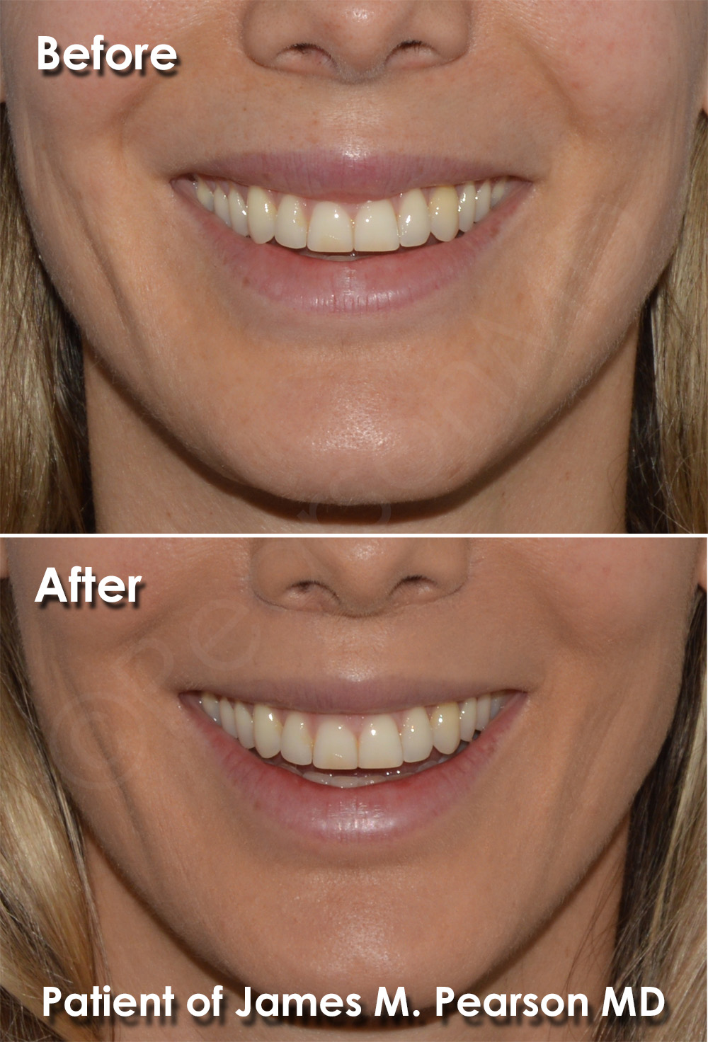 Pearson Plastic Surgery