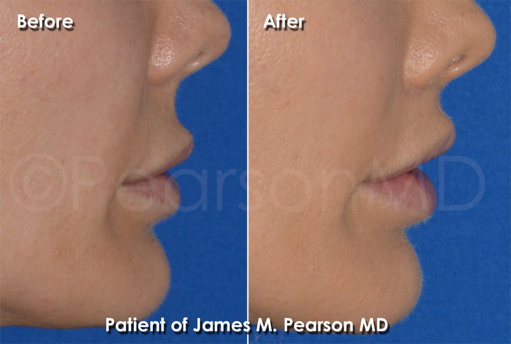 Pearson Plastic Surgery