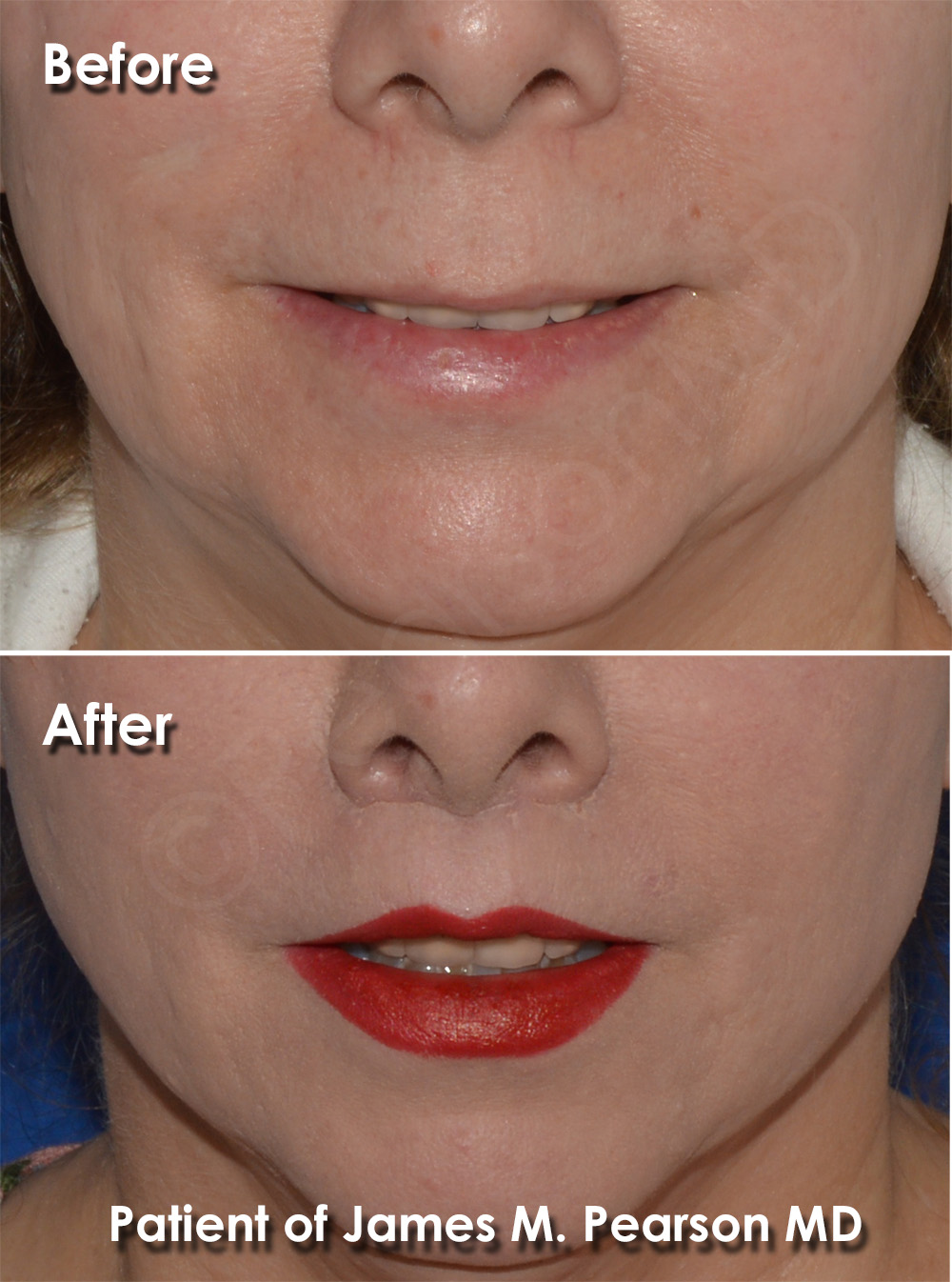 Pearson Cosmetic Surgery