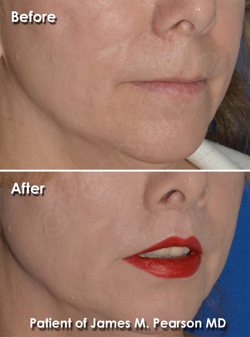 Dr. Pearson Plastic Surgery