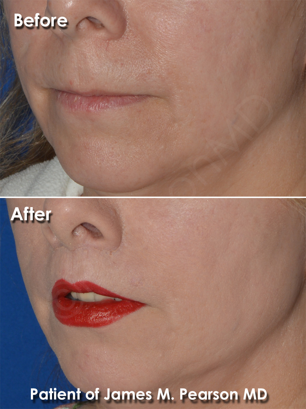 Pearson Plastic Surgery