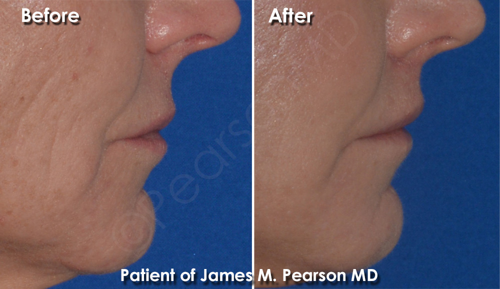 Dr. Pearson Plastic Surgery