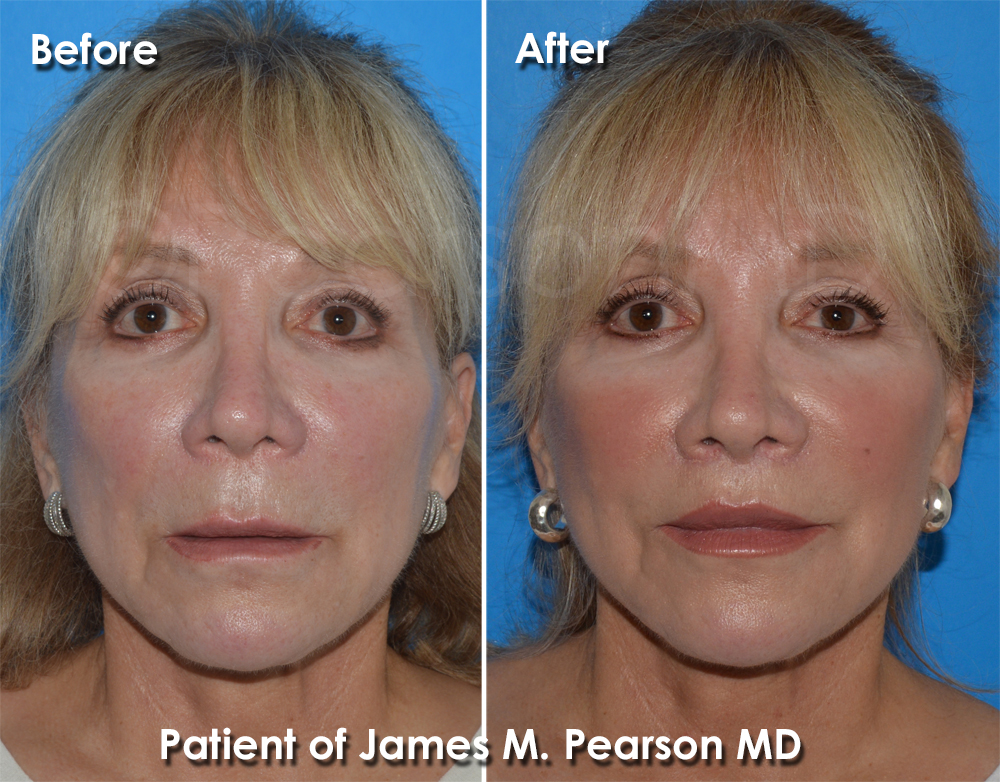 Pearson Cosmetic Surgery