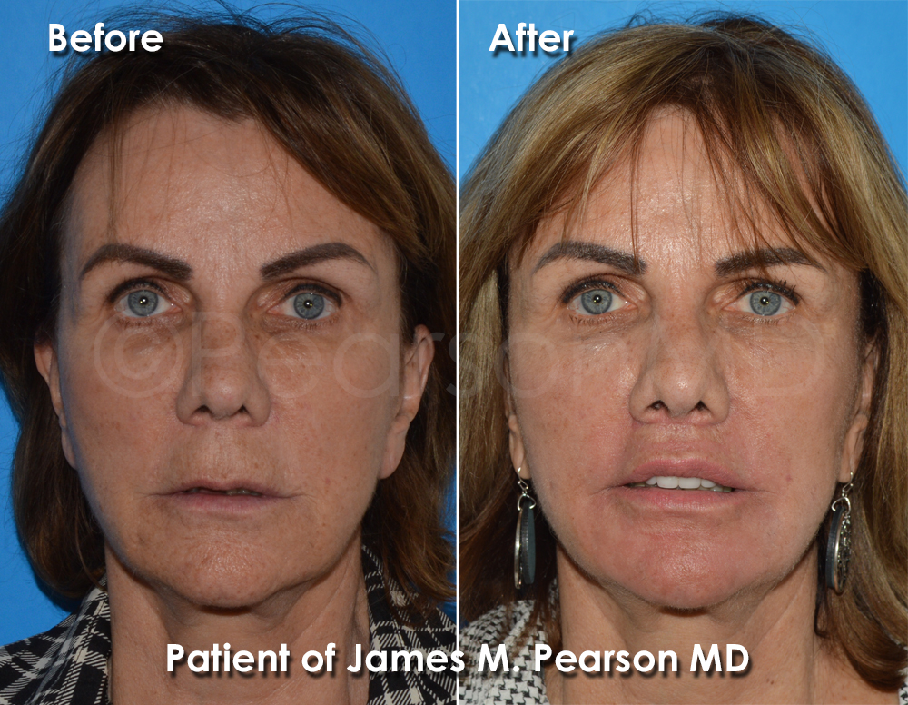 Pearson Cosmetic Surgery