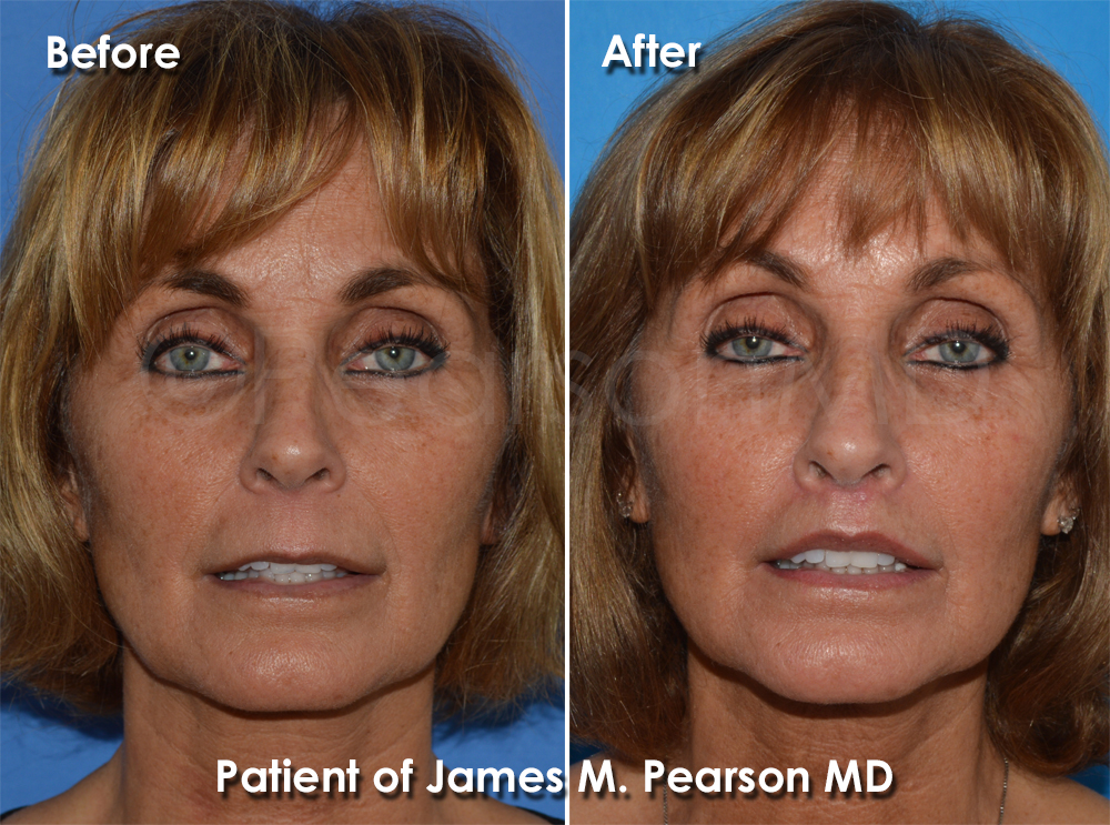 Pearson Cosmetic Surgery