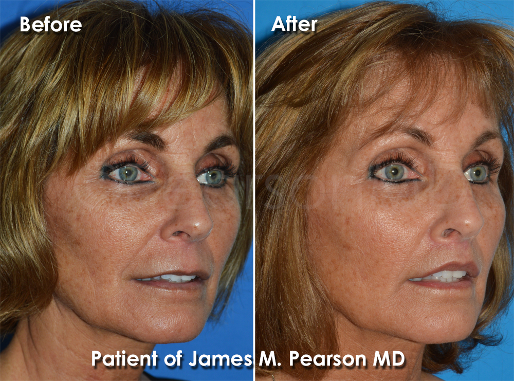Dr. Pearson Plastic Surgery