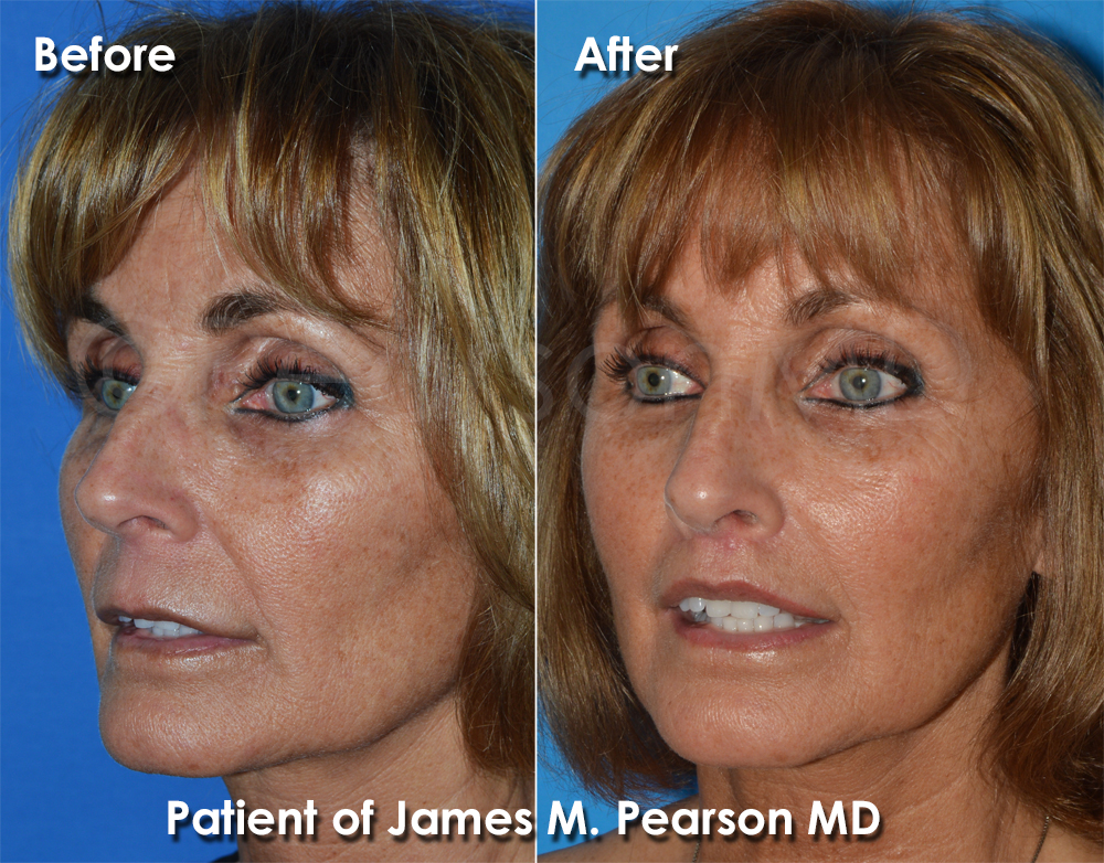 Dr. Pearson Cosmetic Surgery