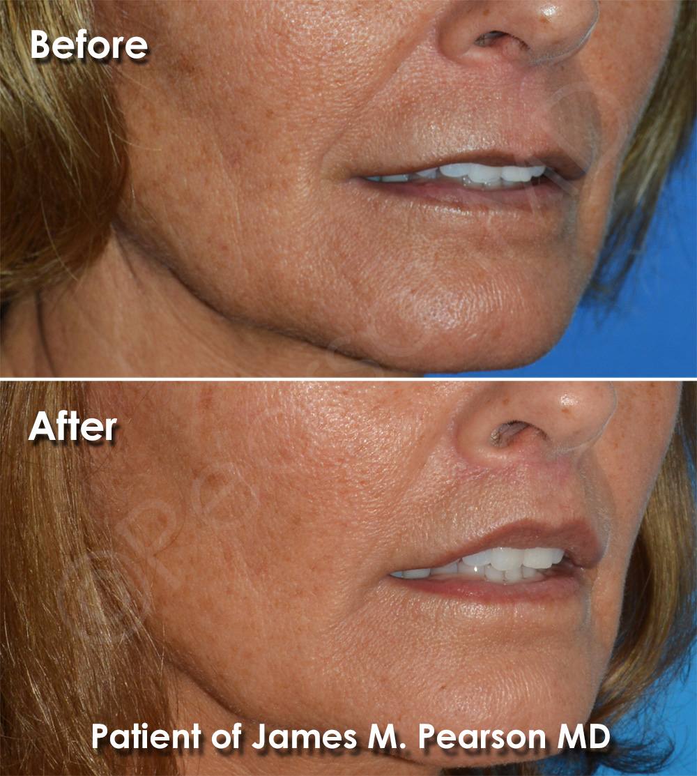 Pearson Plastic Surgery