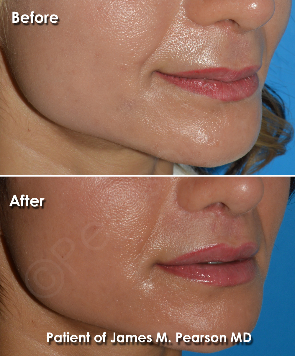 Pearson Cosmetic Surgery