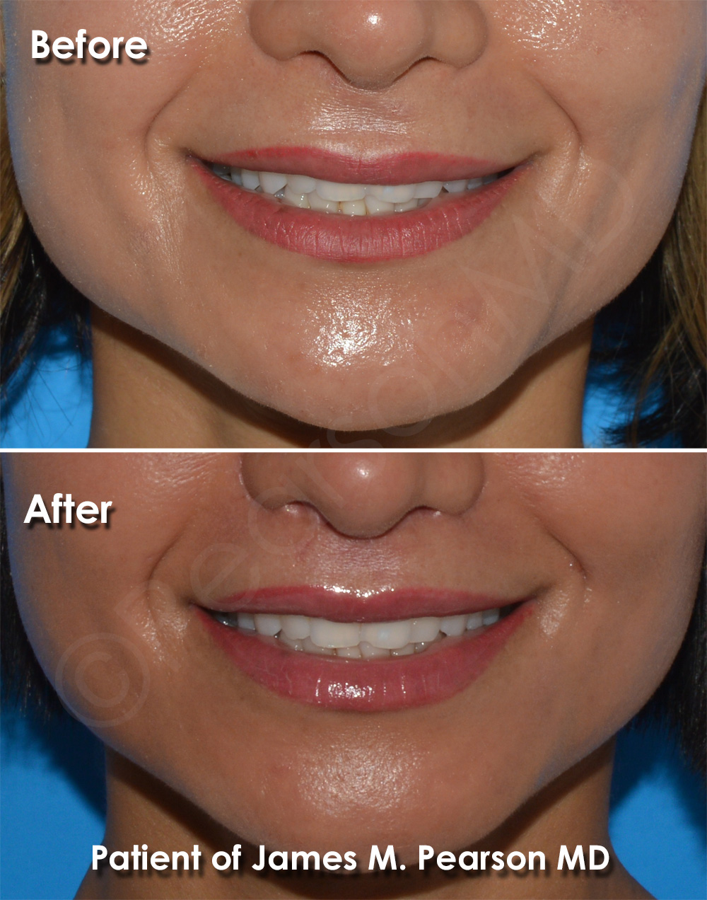 Pearson Plastic Surgery