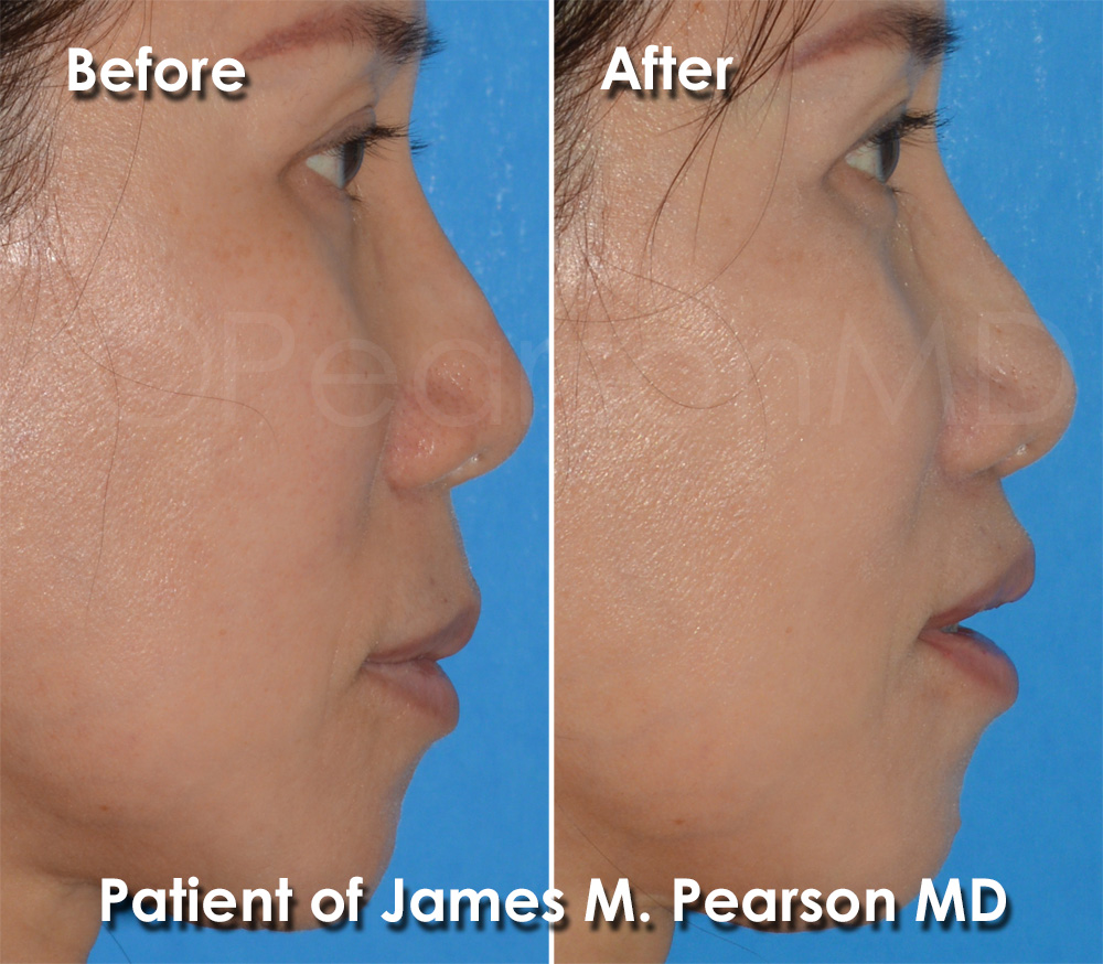 Pearson Plastic Surgery