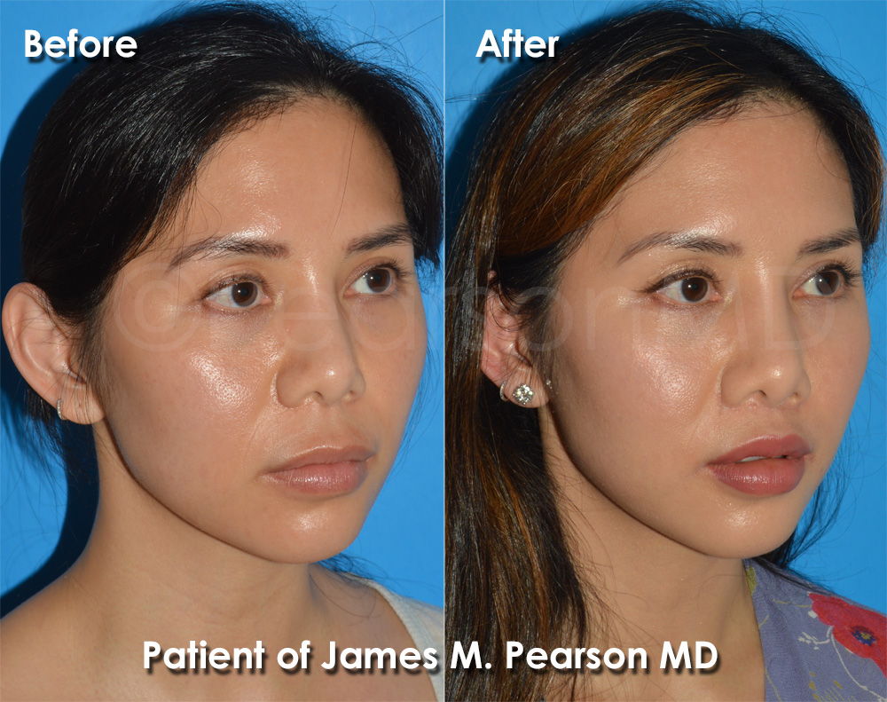 Dr. Pearson Cosmetic Surgery