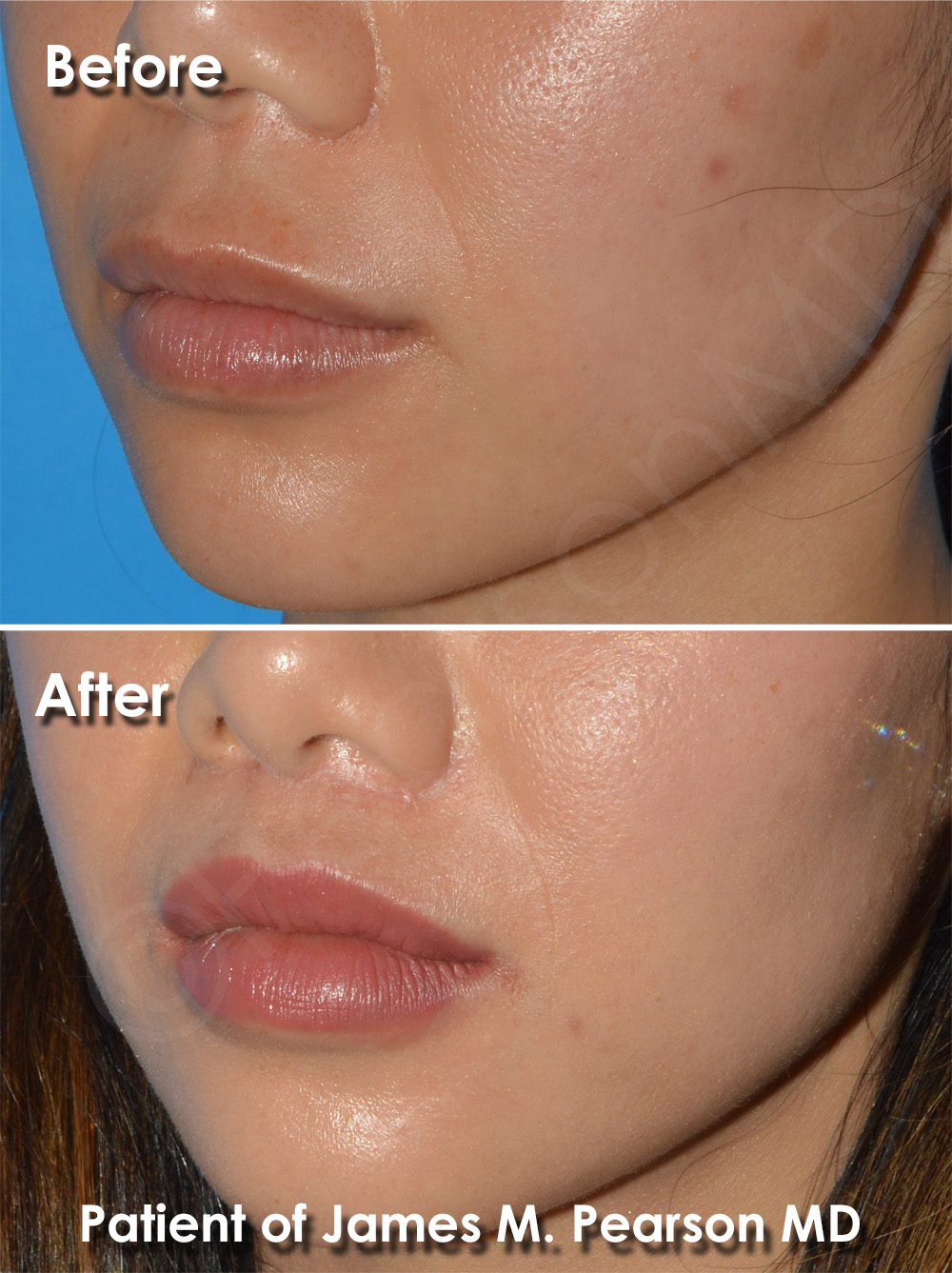 Manhttan Beach Plastic Surgery