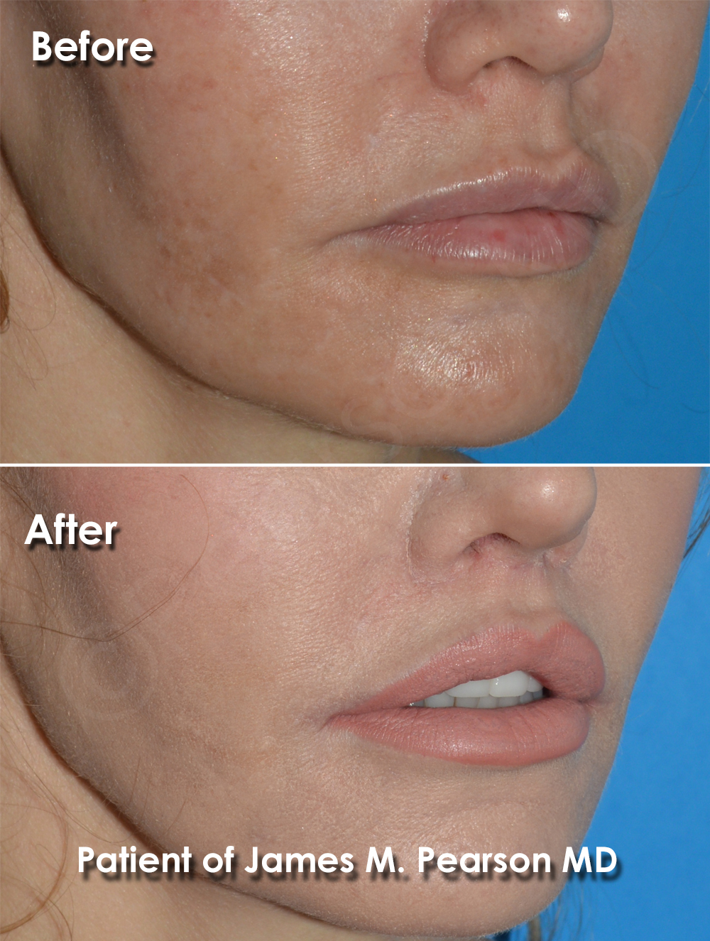 Dr. Pearson Plastic Surgery