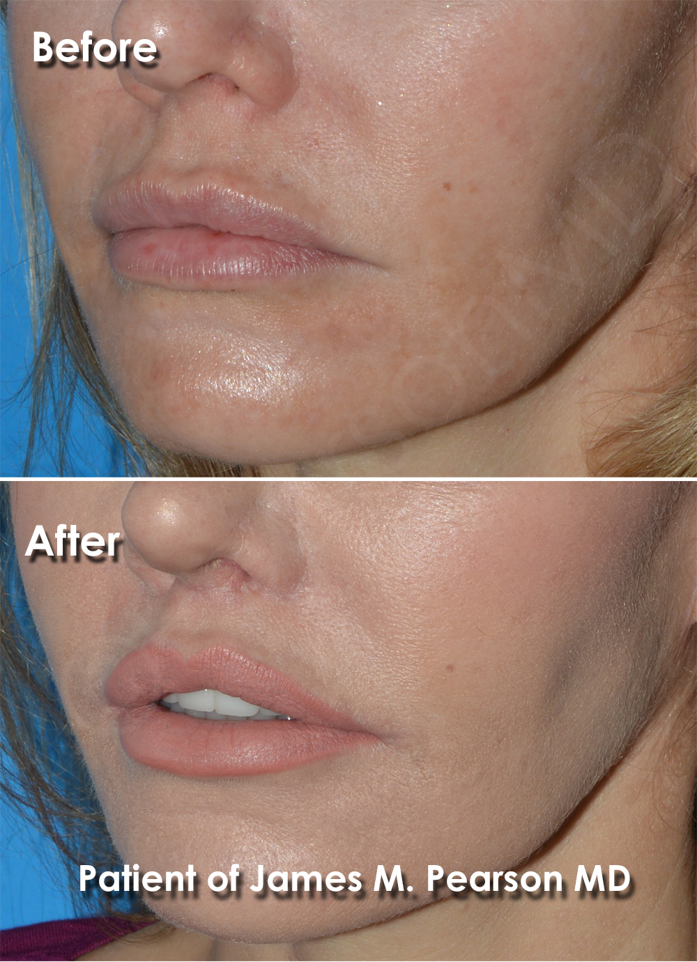Pearson Plastic Surgery