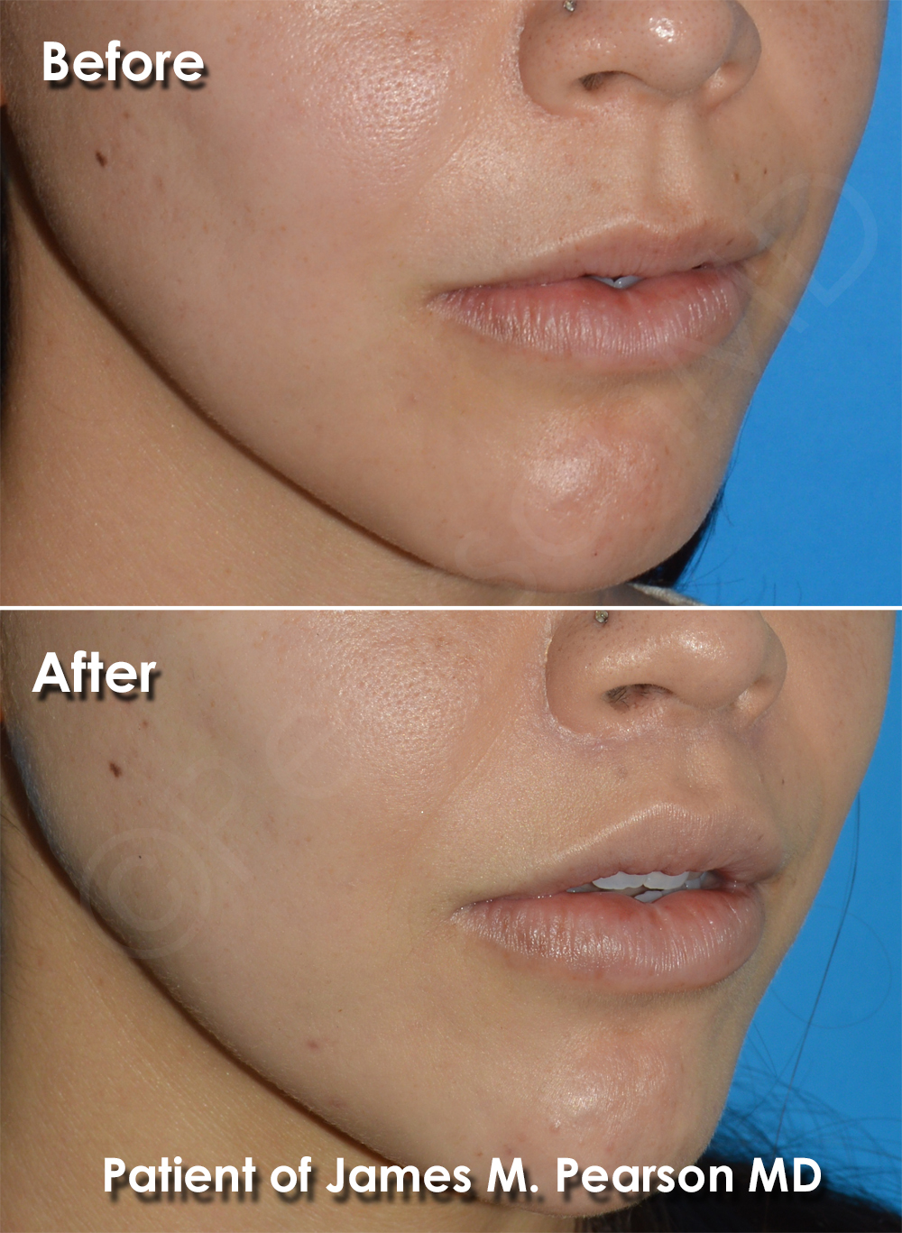 Dr. Pearson Plastic Surgery