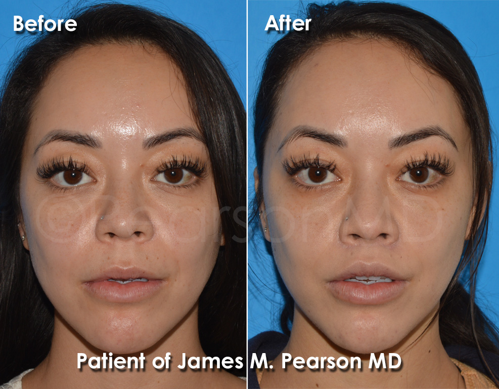 Pearson Plastic Surgery