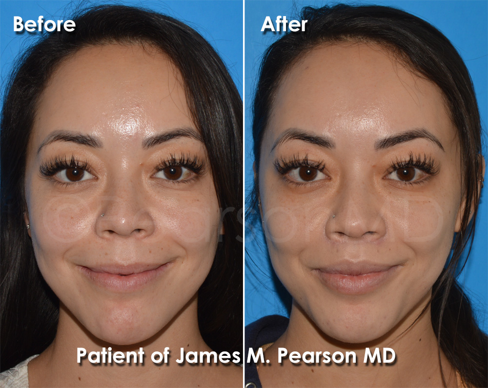 Dr. Pearson Plastic Surgery