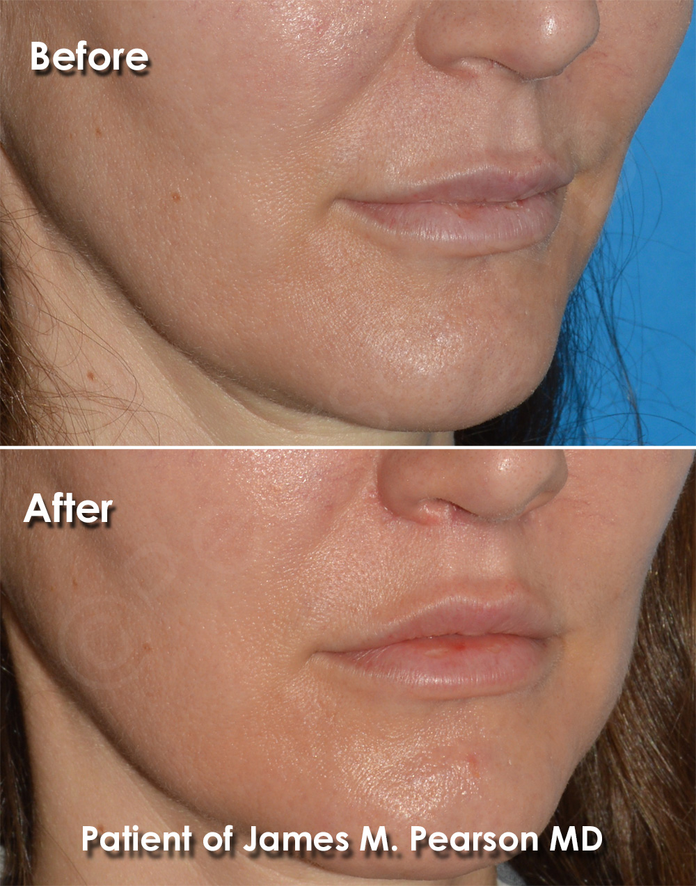 Pearson Plastic Surgery