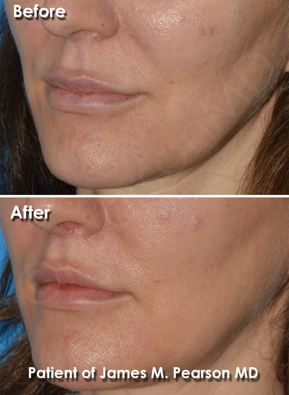 Pearson Cosmetic Surgery