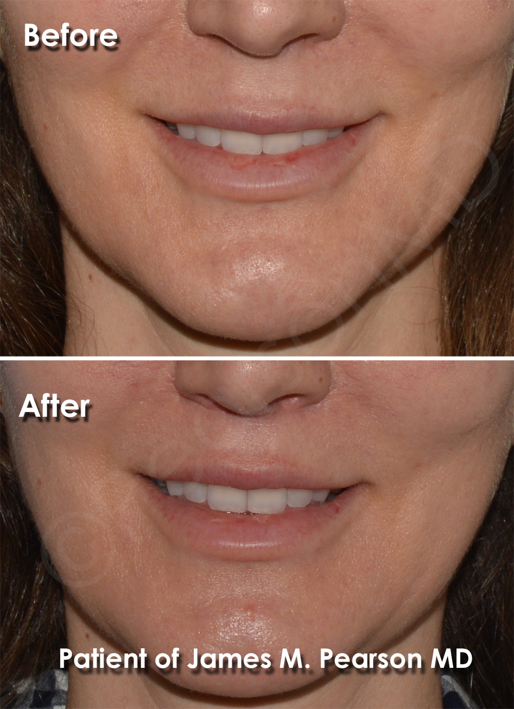Dr. Pearson Cosmetic Surgery