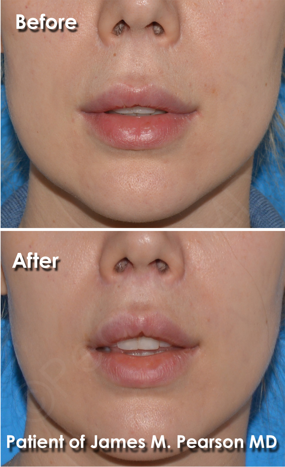 Pearson Plastic Surgery