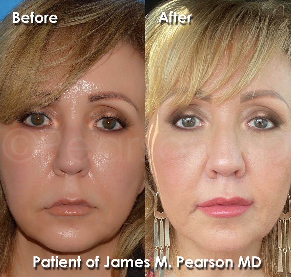 Pearson Cosmetic Surgery