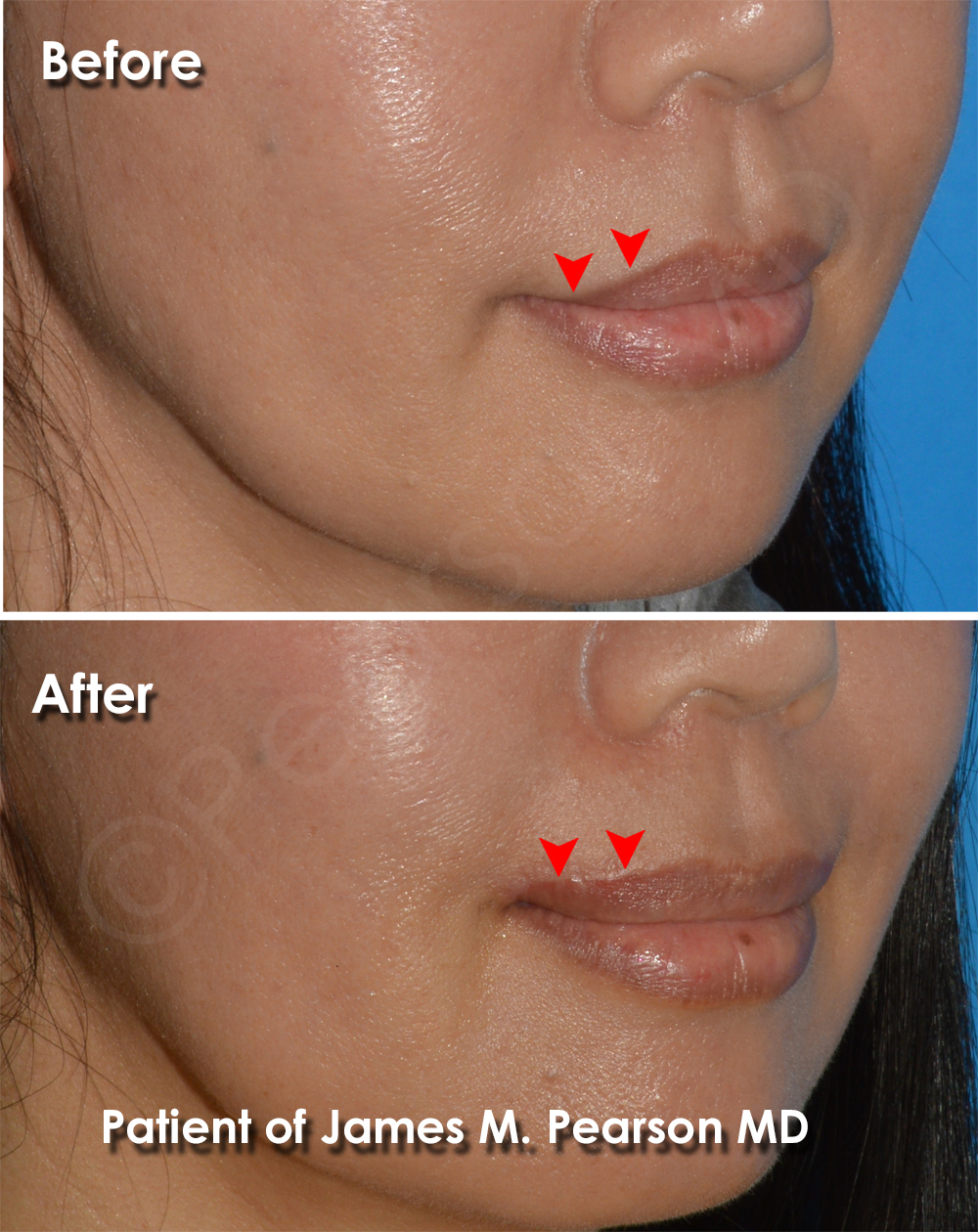 Dr. Pearson Cosmetic Surgery