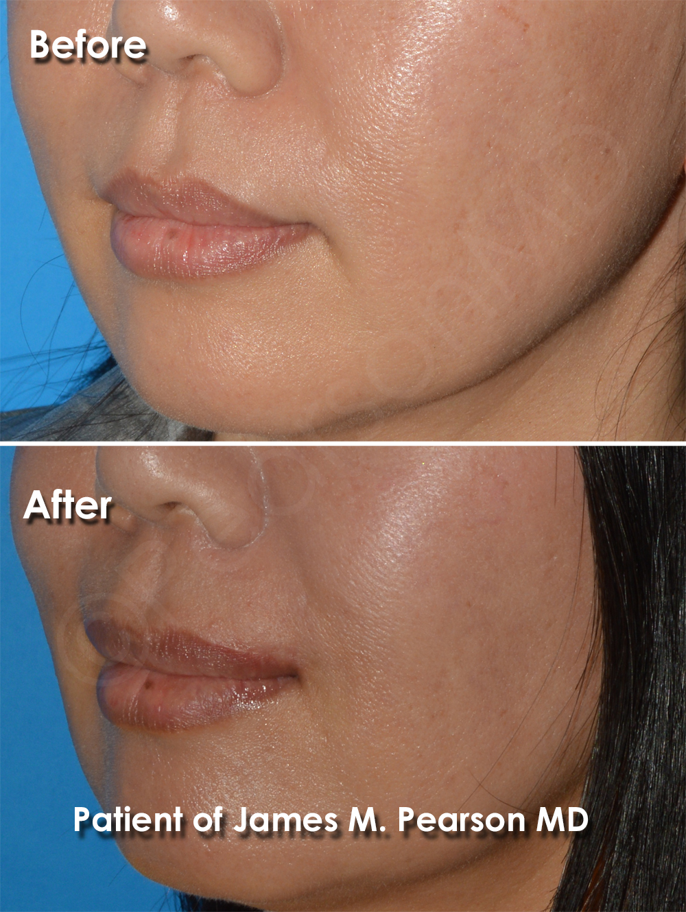 Dr. Pearson Plastic Surgery