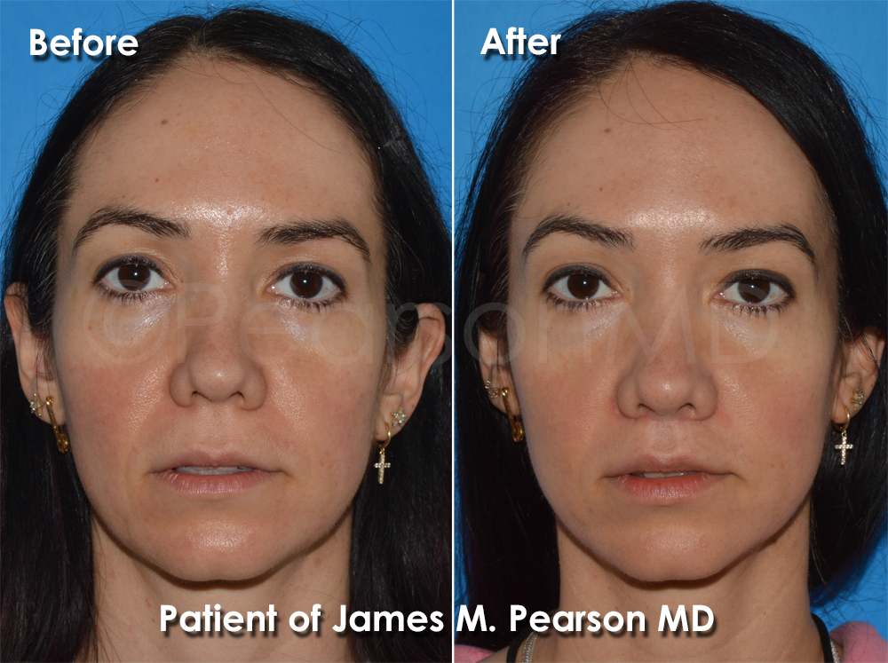 Pearson Plastic Surgery