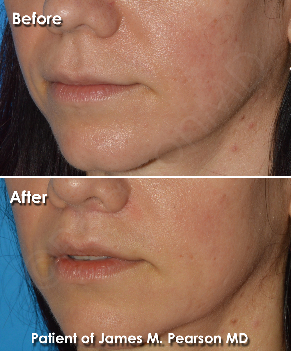 Pearson Cosmetic Surgery