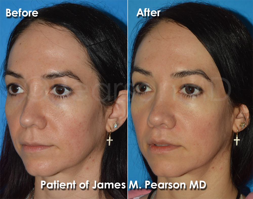 Dr. Pearson Cosmetic Surgery