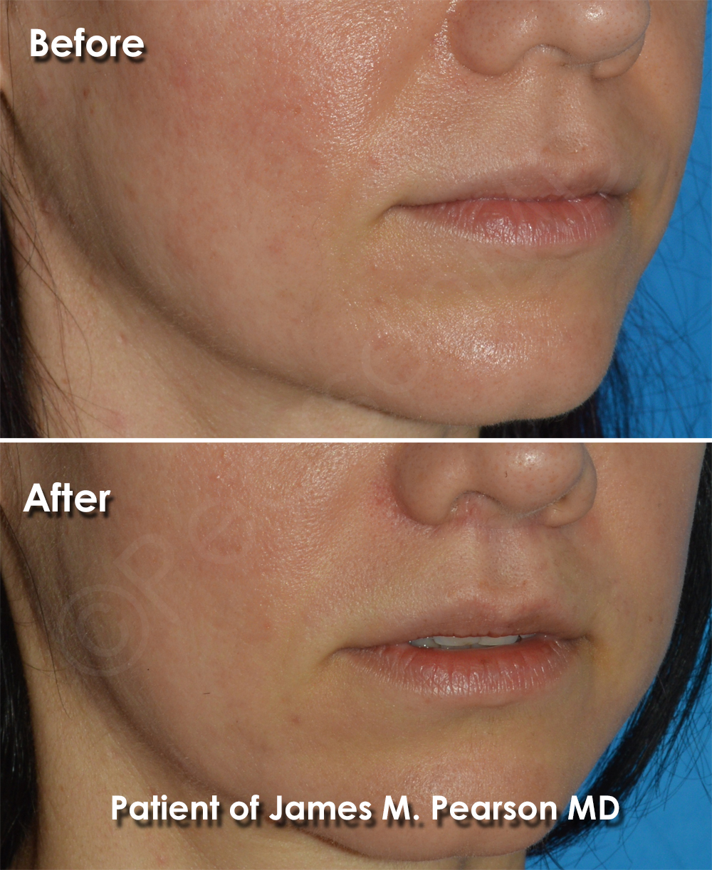 Dr. Pearson Plastic Surgery