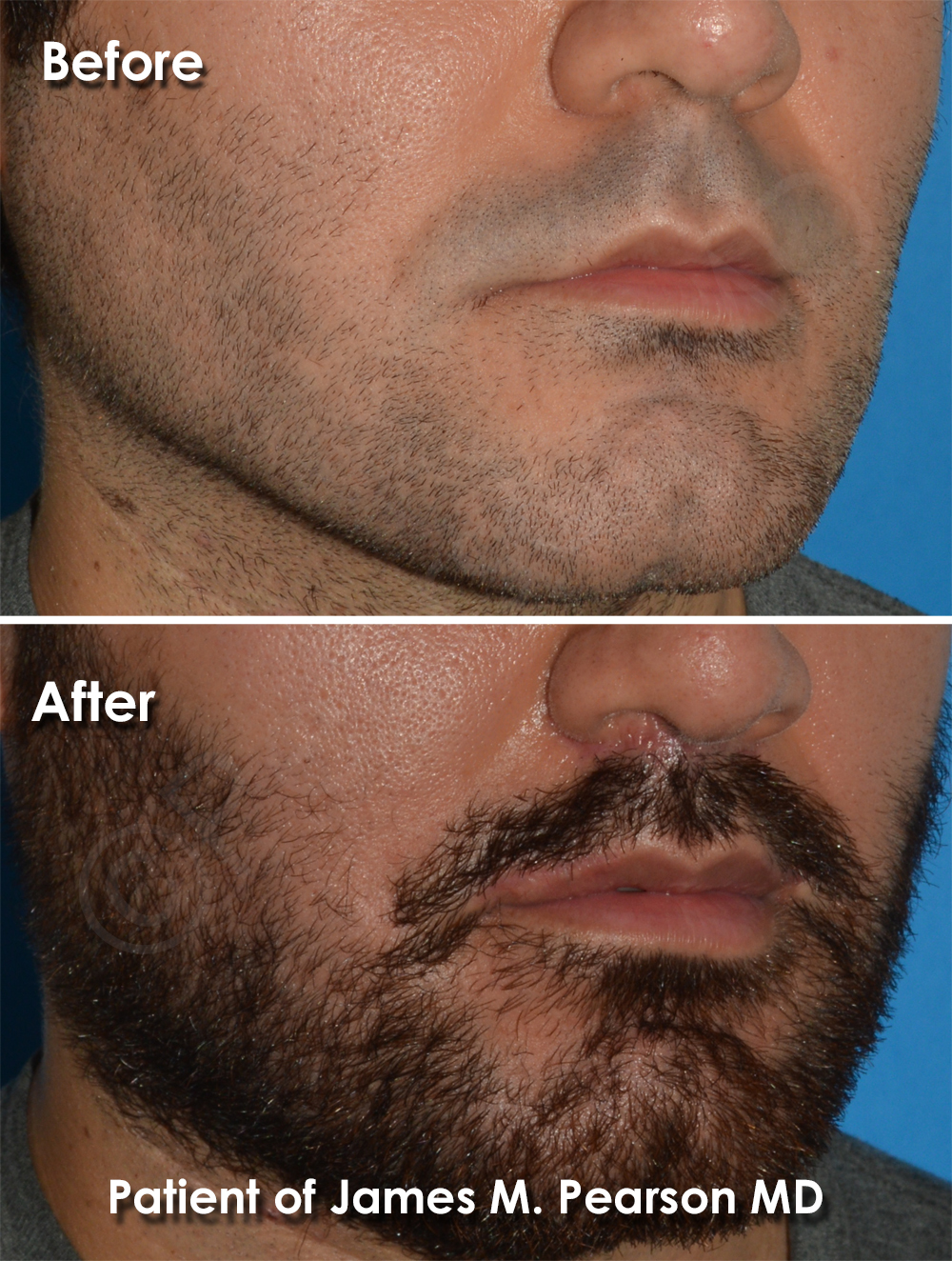 Pearson Cosmetic Surgery