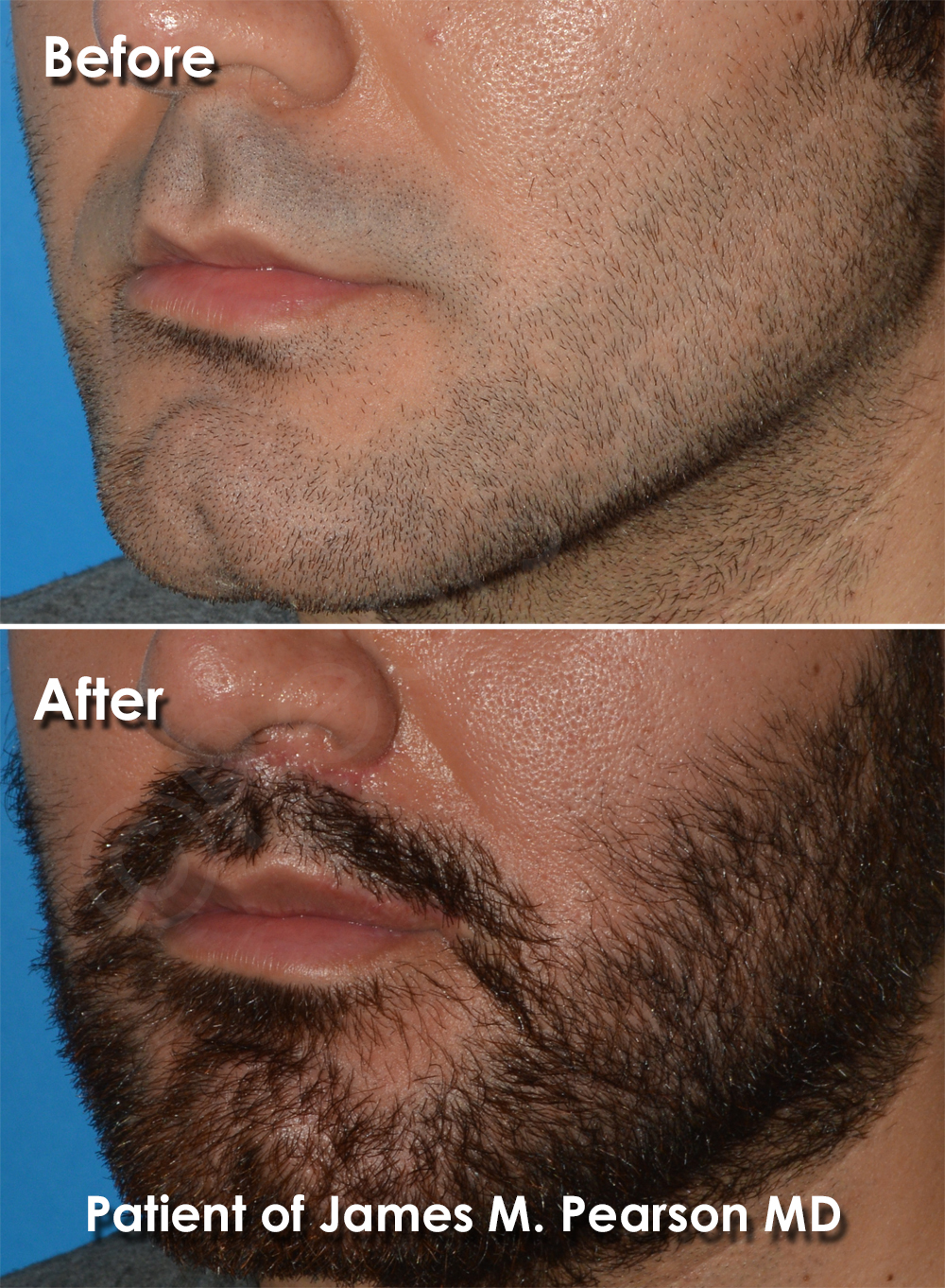 Pearson Plastic Surgery
