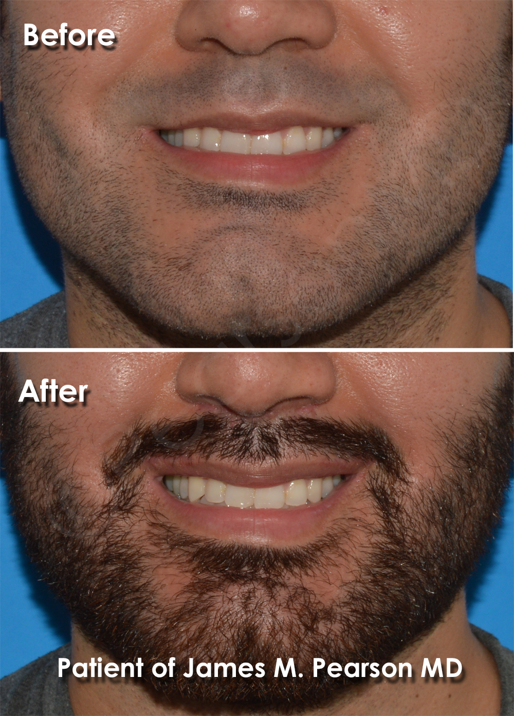 Dr. Pearson Plastic Surgery