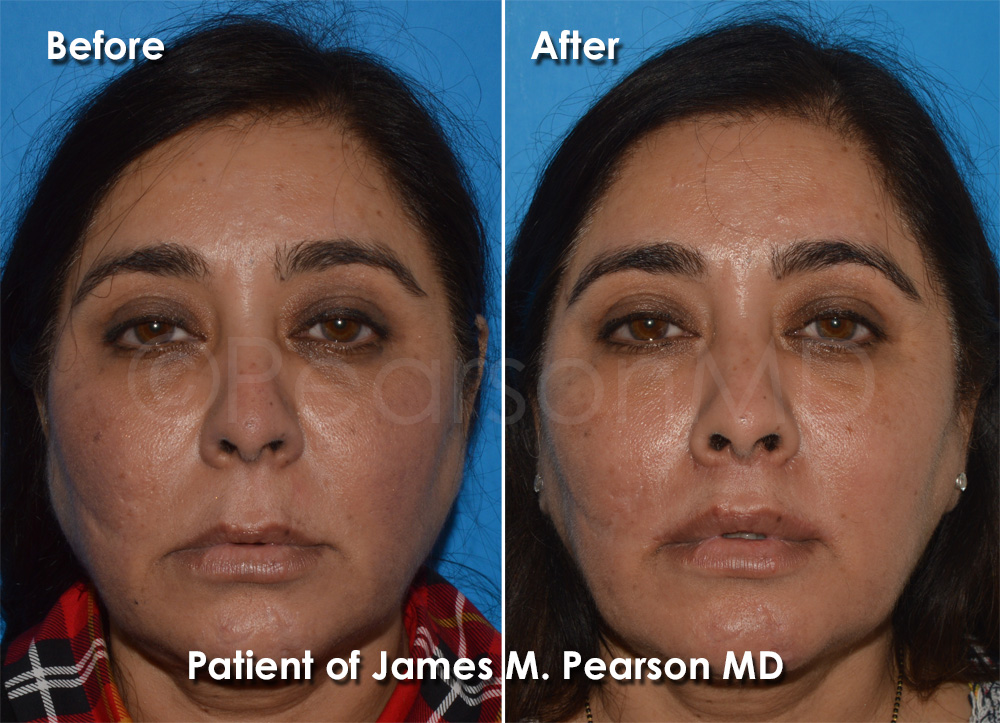 Pearson Plastic Surgery
