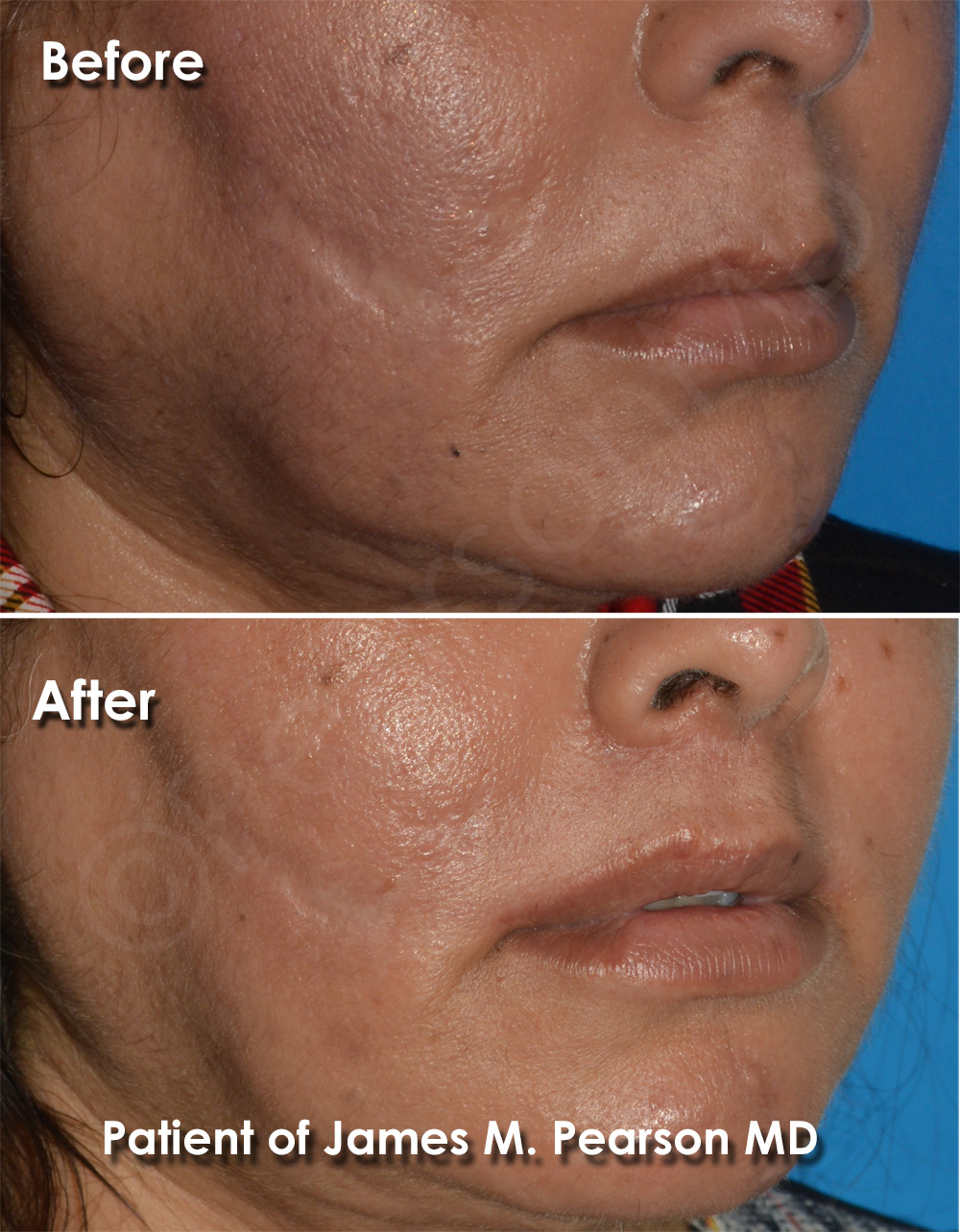 Pearson Cosmetic Surgery