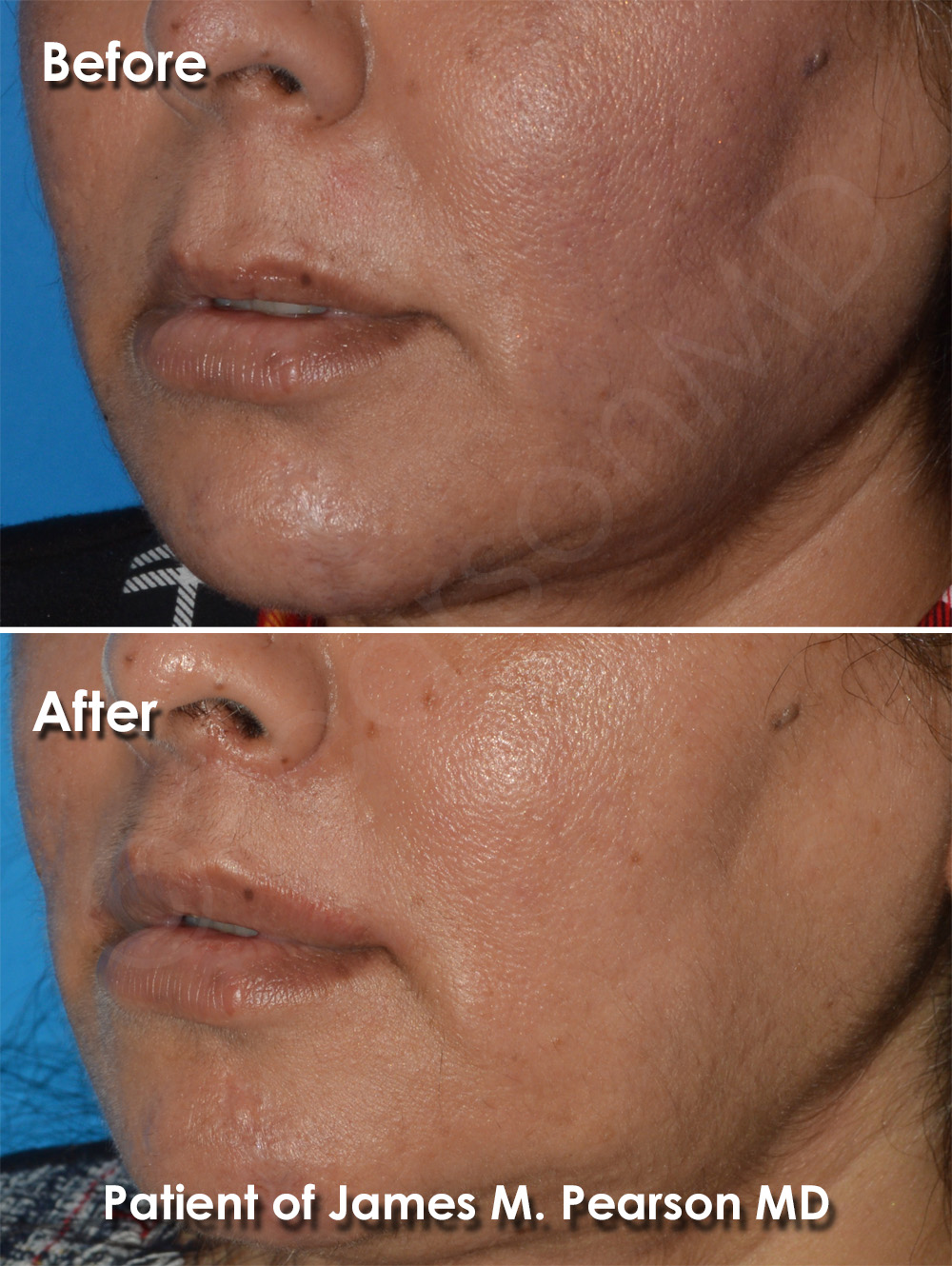 Pearson Plastic Surgery