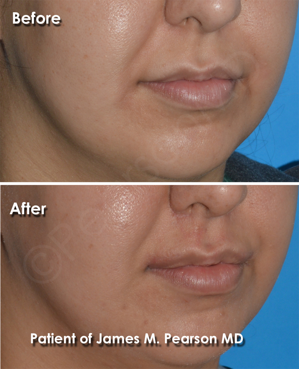 Pearson Plastic Surgery