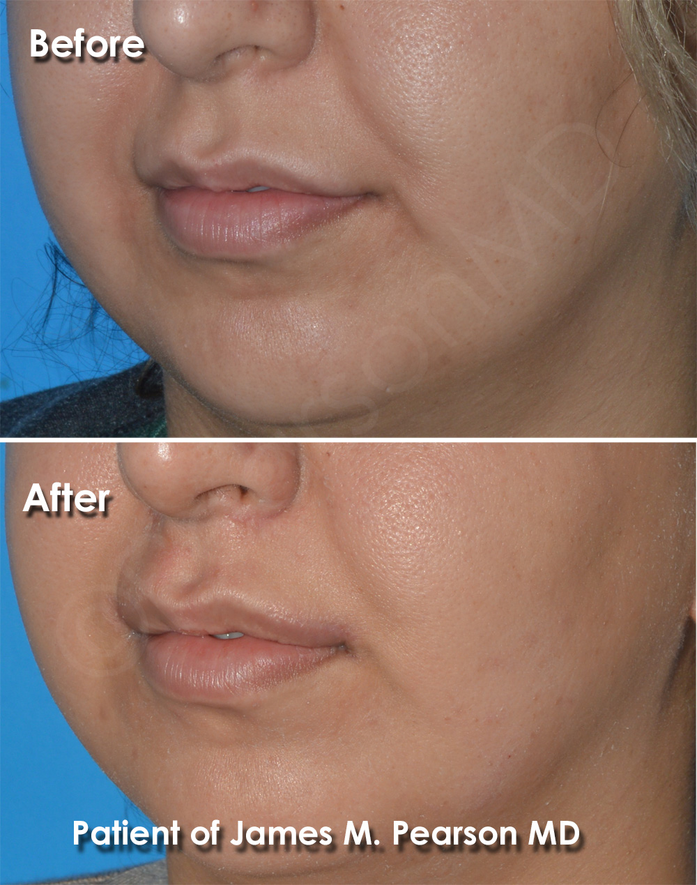 Pearson Cosmetic Surgery