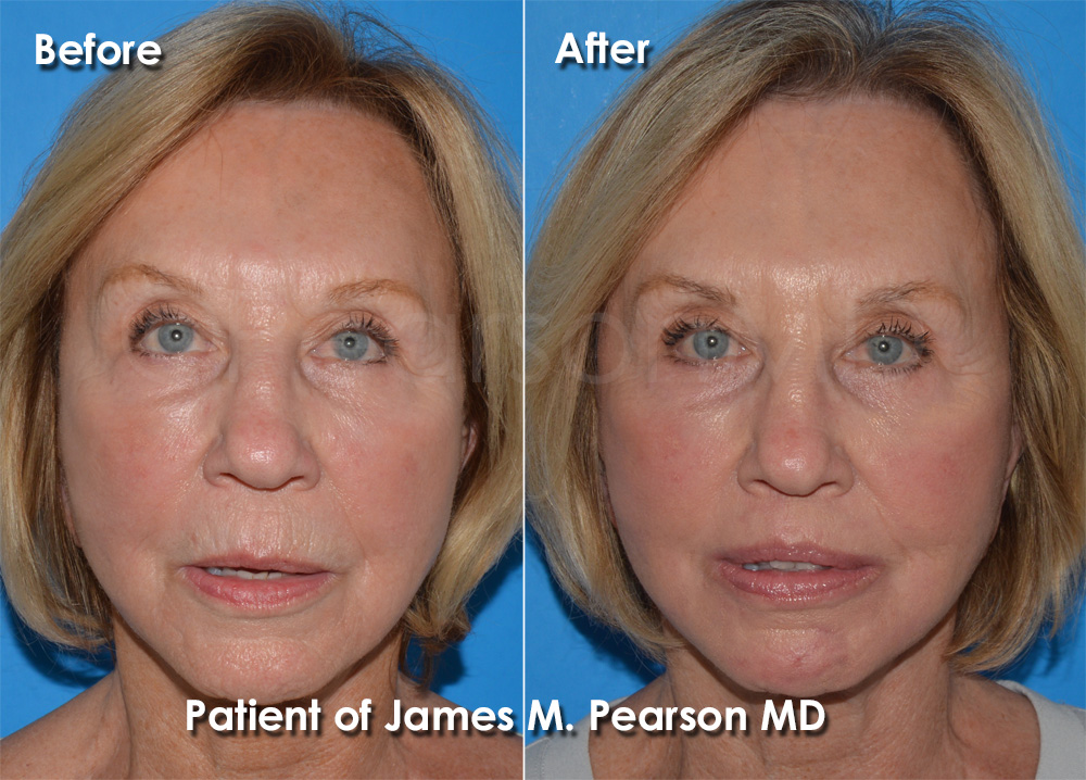 Pearson Cosmetic Surgery
