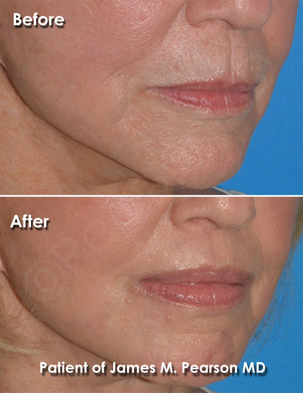 Pearson Plastic Surgery
