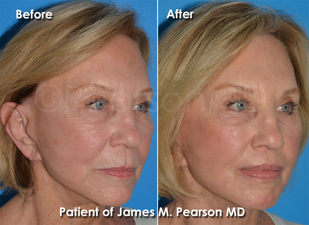 Dr. Pearson Plastic Surgery