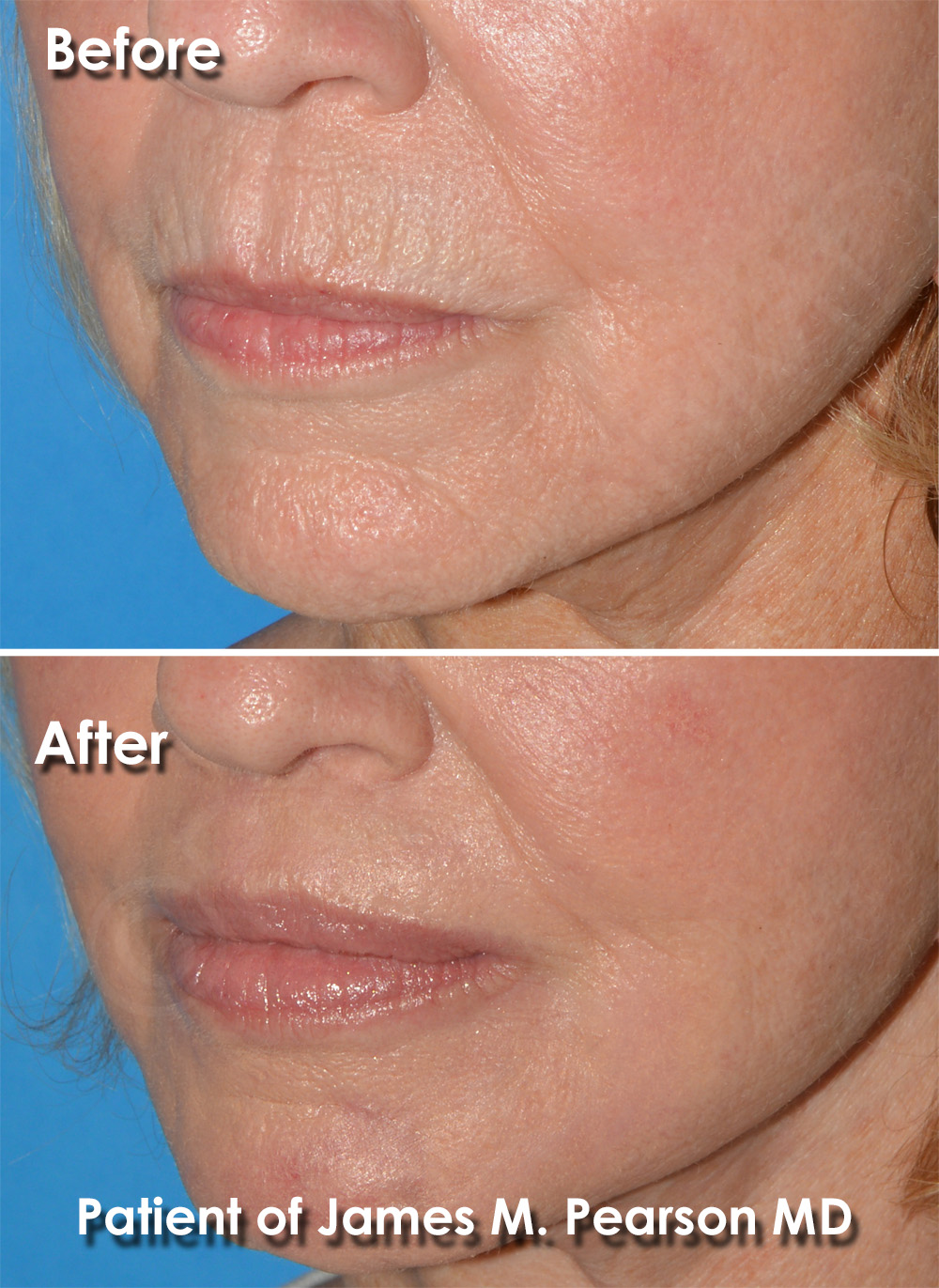 Pearson Plastic Surgery